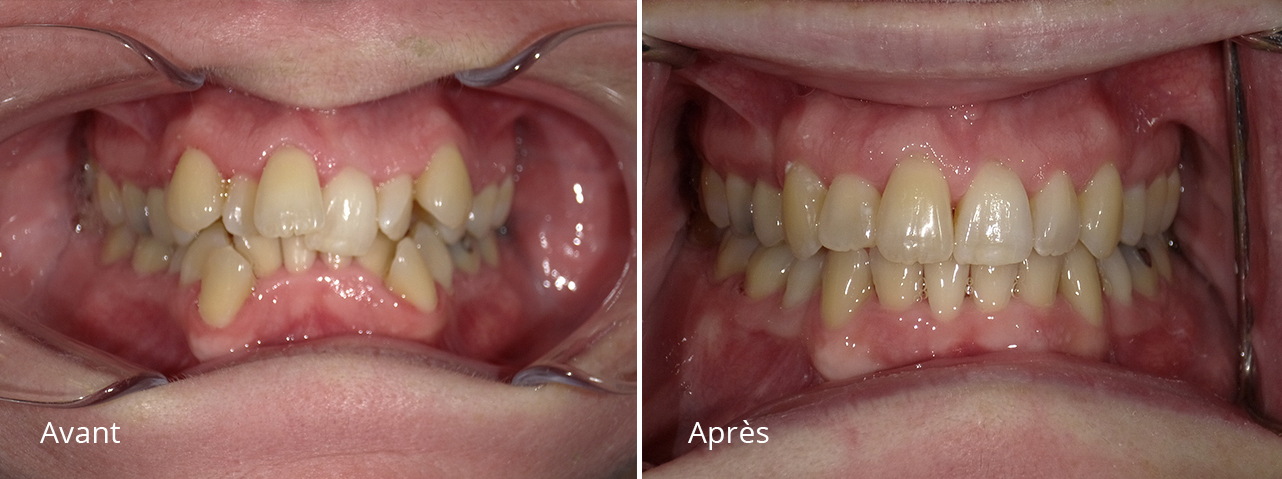 _Orthodontie